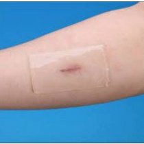 Albio Scar Reduction Gel Sheet for Scars 5 cm x 5 cm Scars Fades Away (2)