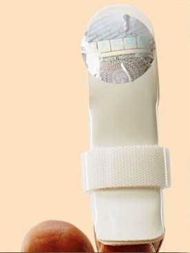 Apex Frog Splint Fs03 Small