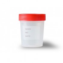 JLab Urine Container (Plastic) - 60 ml