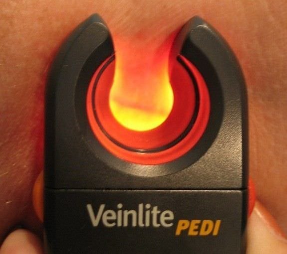 Medicare Veinlite PEDI - VeinFinder