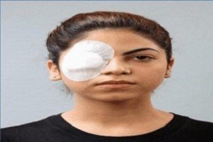 Ortholink Eye Pad Eco (set of2)