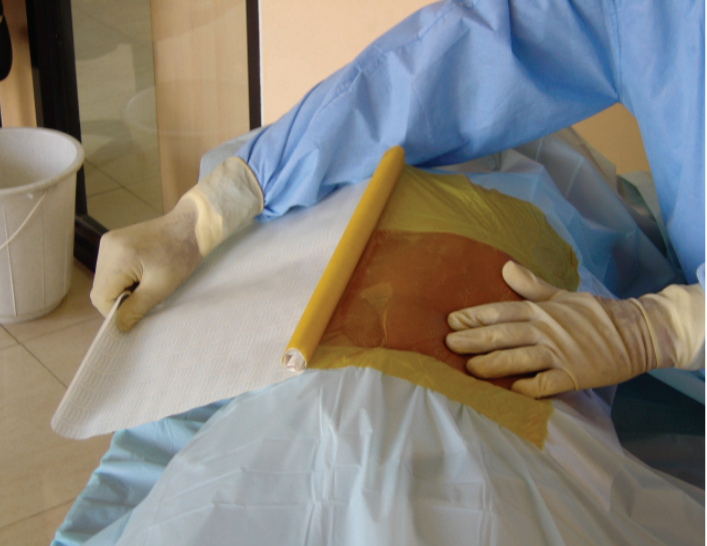 Ortholink Io-Drape 6090 2-Size 90x90 cm, adhesive 60x90cm