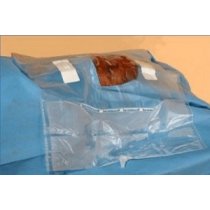 Ortholink Phaco I Drape