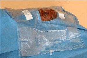 Ortholink Phaco I drape withfabric