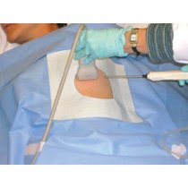 Ortholink Ultra sound Drape - Size 15x250 cm