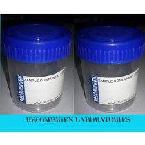 Recombigen Urine Container 50ml ETO-Sterilized,TD730604-060
