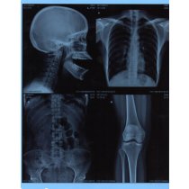 X-Ray Films-14*17 (inches)(100)