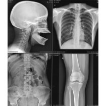 X-Ray Films- 8*10 (inches)(100)