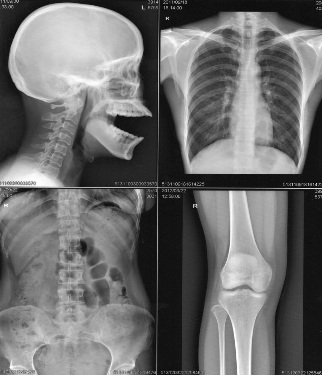 X-Ray Films-A4 size(100)